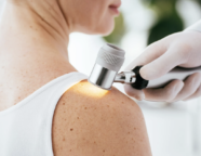 Guide télédermatologie
