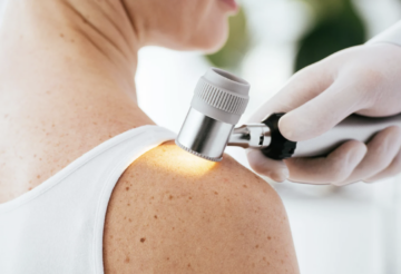 Projet Télédermatologie