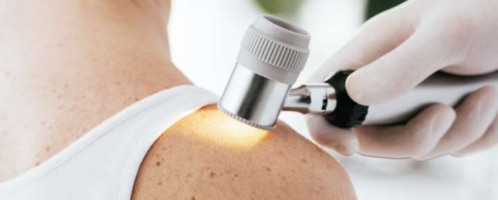 Projet Télédermatologie